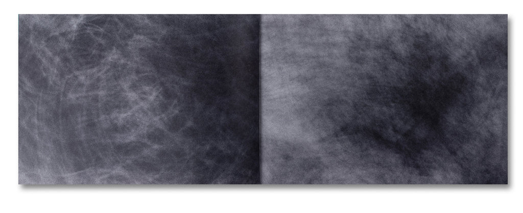 Tacita Dean - Why Cy